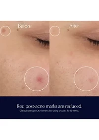 Advanced Night Repair Rescue Solution Serum with 15% Bifidus Ferment