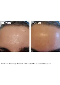 Beauty Flash Peel with BHA & AHA