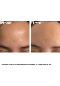 Beauty Flash Peel with BHA & AHA