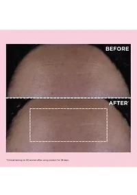 Multi-Active Day Moisturizer for Lines, Pores, Glow with Niacinamide 