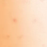 One-Step Gentle Exfoliating Cleanser