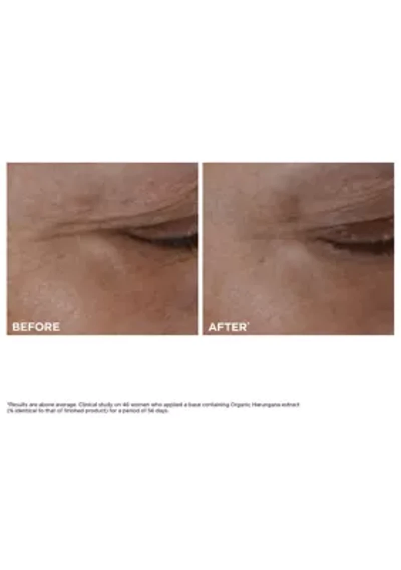 Total Eye Lift Eye Cream for Firming, Wrinkles, Dark Circles & Puffiness