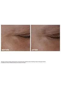 Total Eye Lift Eye Cream for Firming, Wrinkles, Dark Circles & Puffiness