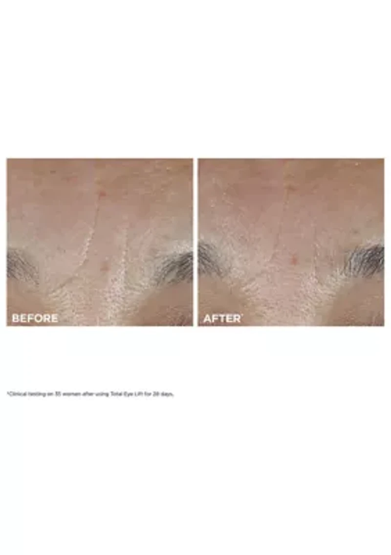 Total Eye Lift Eye Cream for Firming, Wrinkles, Dark Circles & Puffiness