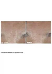 Total Eye Lift Eye Cream for Firming, Wrinkles, Dark Circles & Puffiness