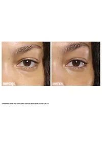 Total Eye Lift Eye Cream for Firming, Wrinkles, Dark Circles & Puffiness
