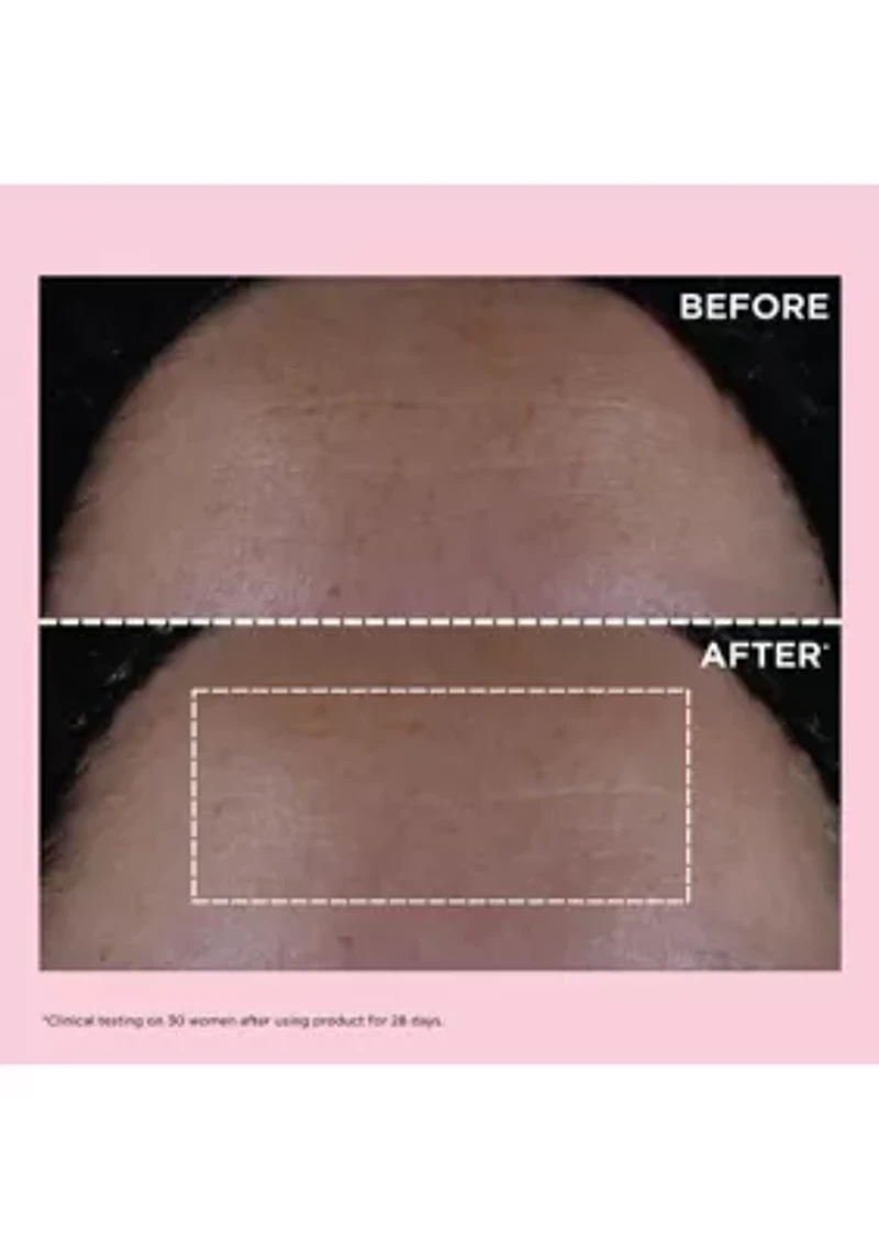 Multi-Active Skincare Starter Set for Lines, Pores, Glow