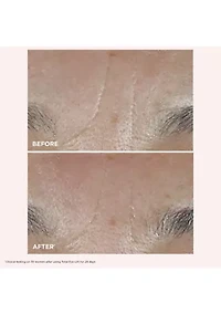 Total Eye Lift Set for Firming, Wrinkles, Dark Circles & Puffiness - $141 Value!