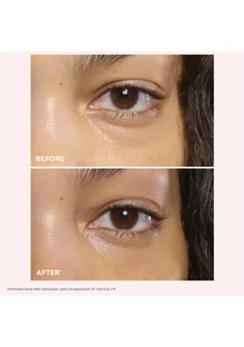 Total Eye Lift Set for Firming, Wrinkles, Dark Circles & Puffiness - $141 Value!