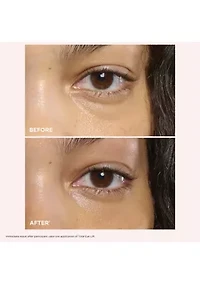 Total Eye Lift Set for Firming, Wrinkles, Dark Circles & Puffiness - $141 Value!