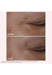 Face & Eyes Anti-Aging Set