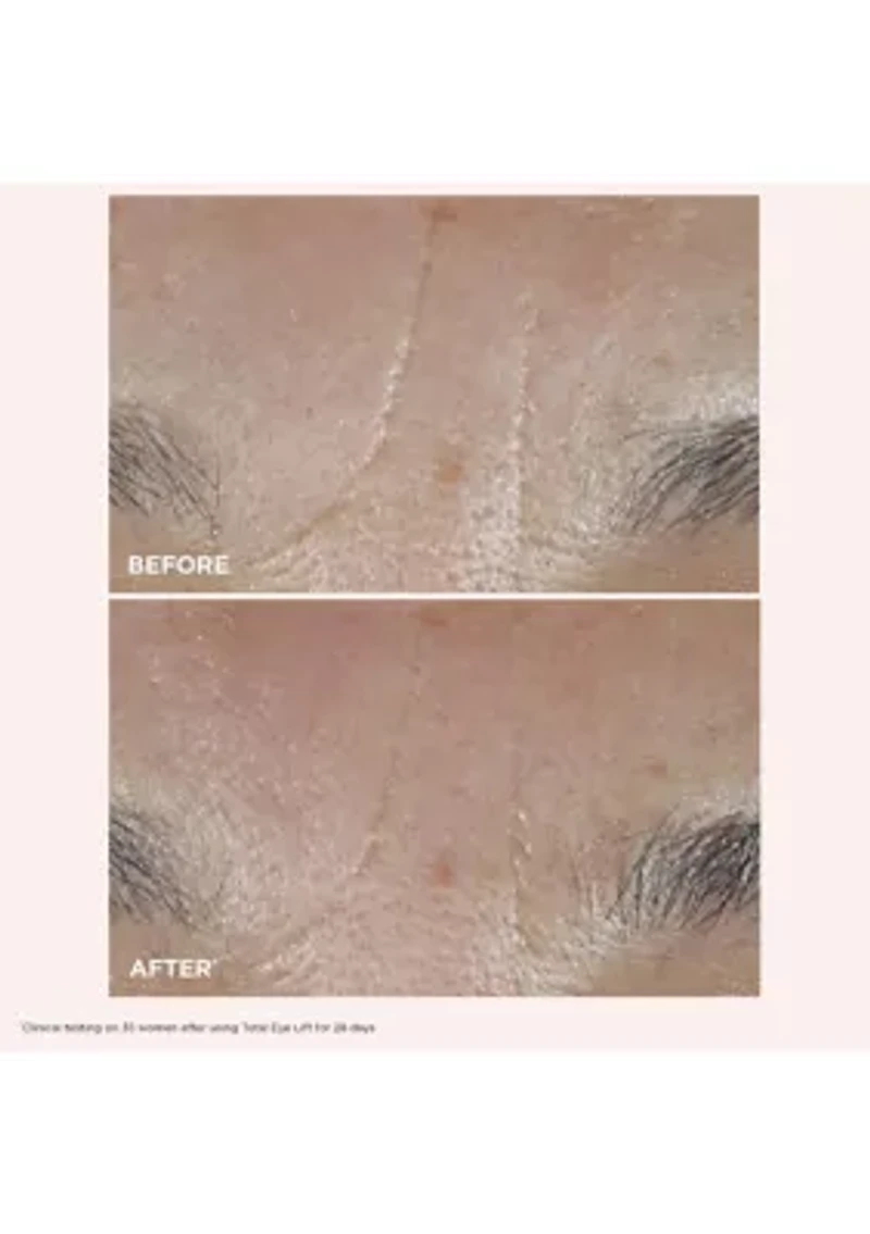 Face & Eyes Anti-Aging Set