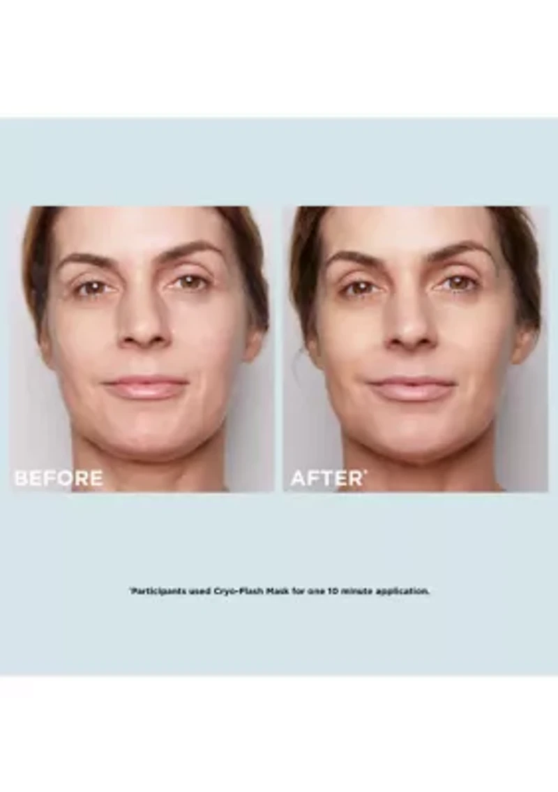 Glow-Boosting Cryo-Flash Mask Set