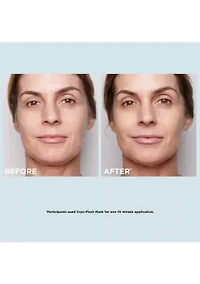 Glow-Boosting Cryo-Flash Mask Set