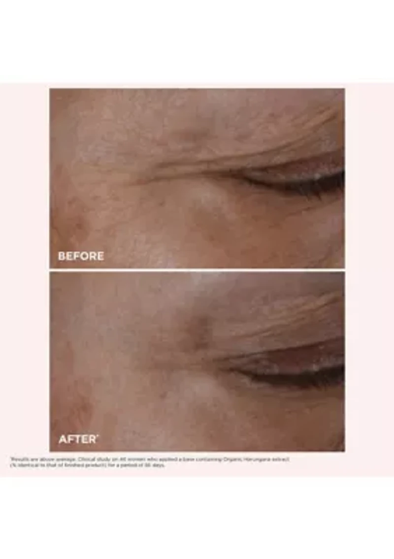 Glow-Boosting Cryo-Flash Mask Set