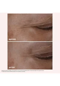 Glow-Boosting Cryo-Flash Mask Set