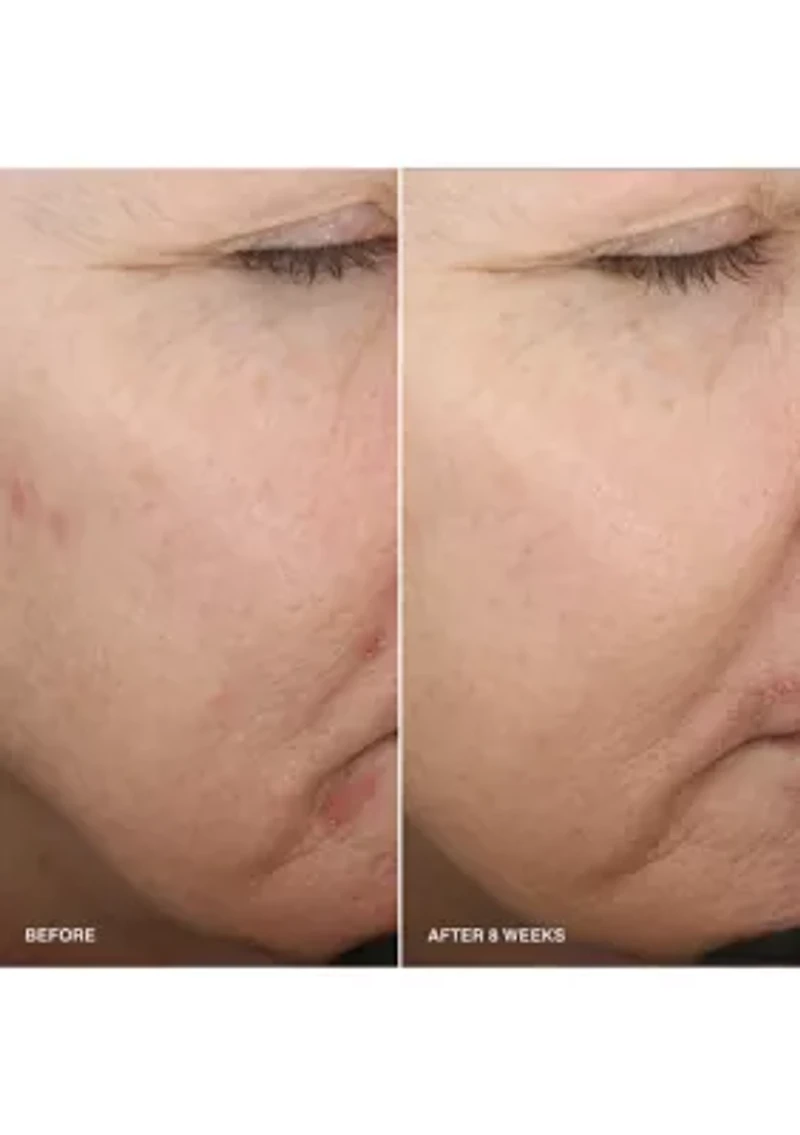 Vitamin Enriched Smoothing Serum with Niacinamide 