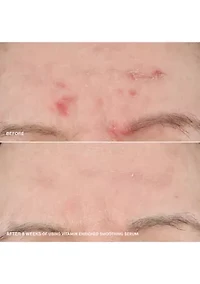 Boost Your Base Vitamin Enriched Moisturizer and Serum Set - $154 Value!