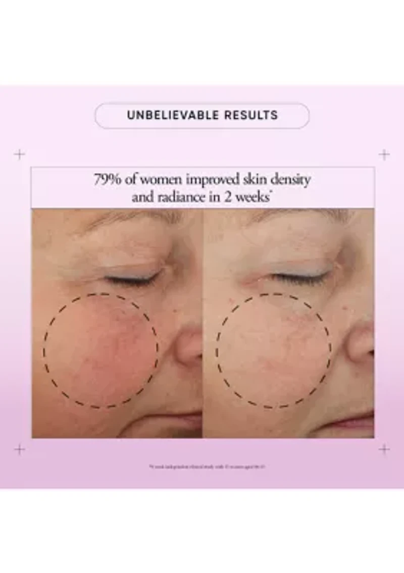 Ultimate Miracle Worker Cream SPF 30