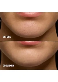 The POREfessional Degunker Blackhead & Pore Cleansing Mask System