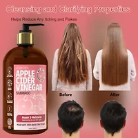 Apple Cider Vinegar Shampoo, Made in USA, 16 oz.