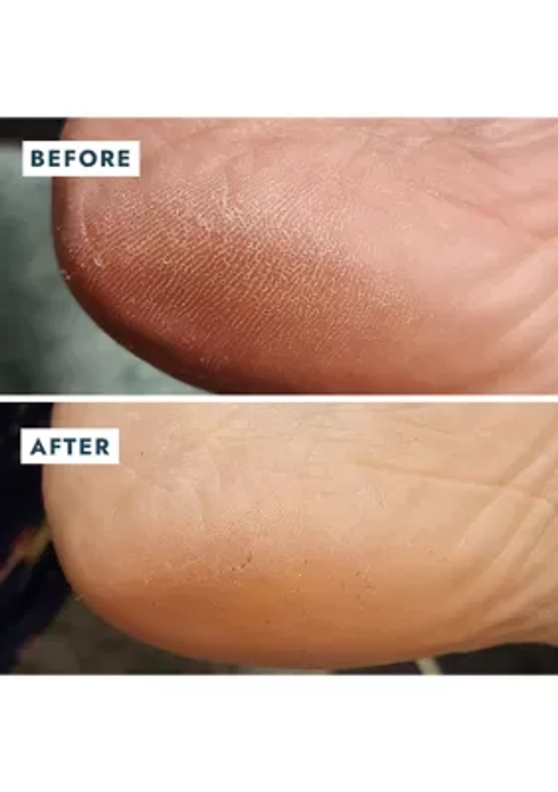 Heel Repair Duo - $23 Value!