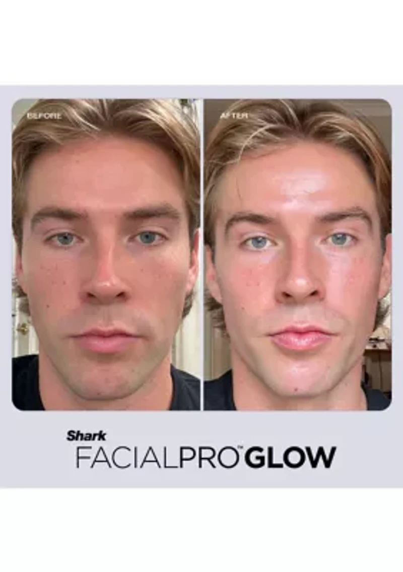 FacialPro Glow At Home Hydro-Powered Facial System