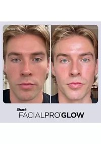 FacialPro Glow At Home Hydro-Powered Facial System