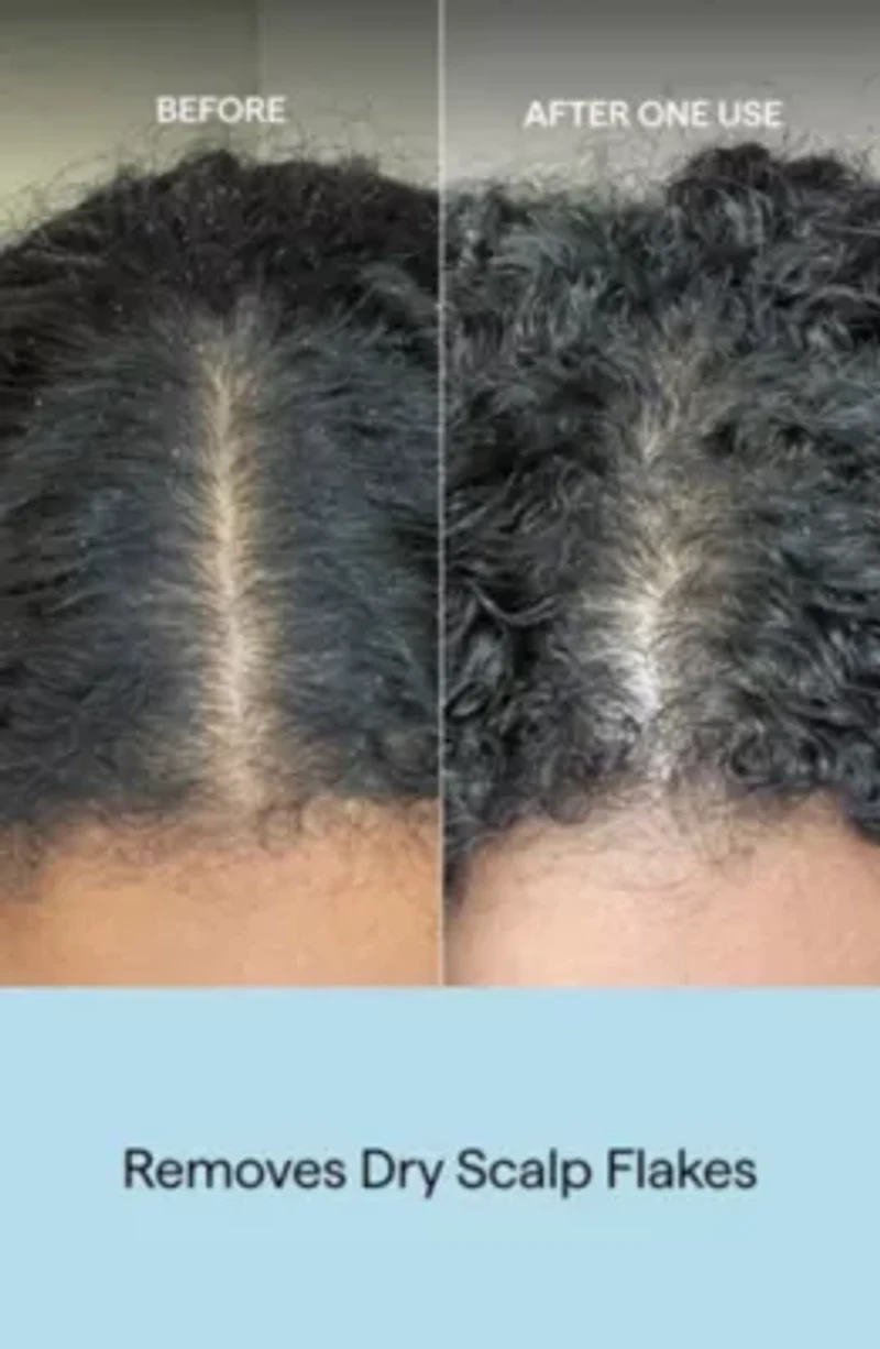 Scalp Revival Charcoal Plus Coconut Oil Exfoliat Shampoo
