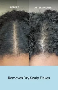 Scalp Revival Charcoal Plus Coconut Oil Exfoliat Shampoo