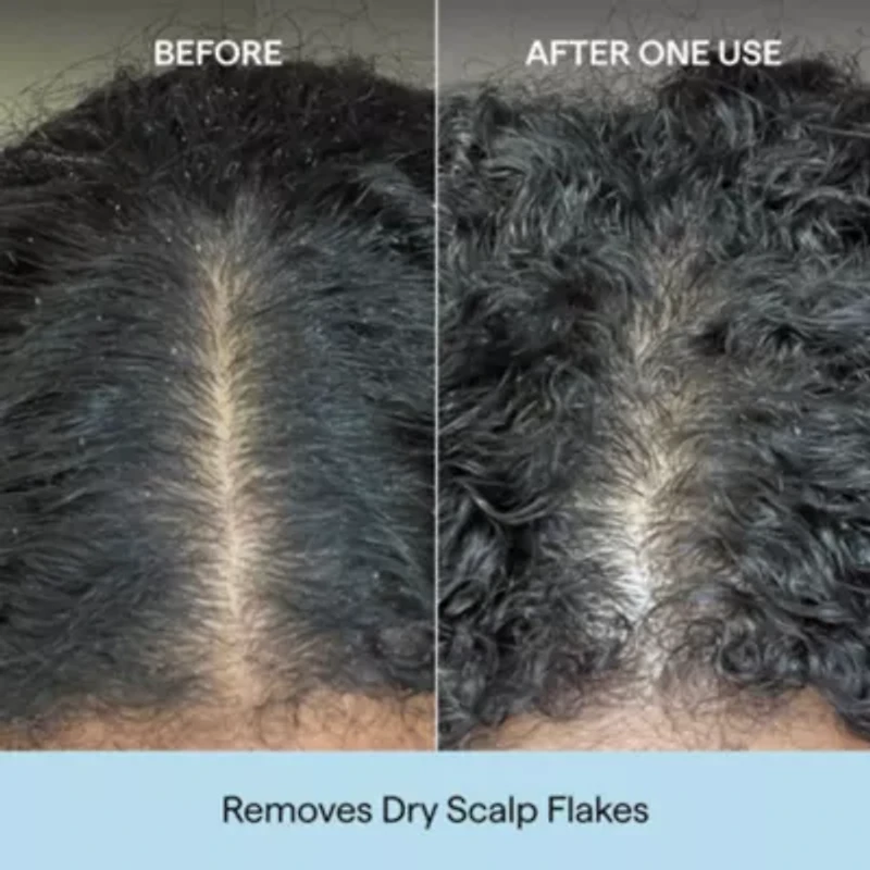 Scalp Revival Charcoal Plus Coconut Oil Micro-Exfoliating Shampoo