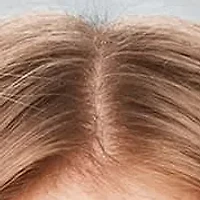 Scalp Revival Charcoal Plus Tea Tree Cooling Hydration