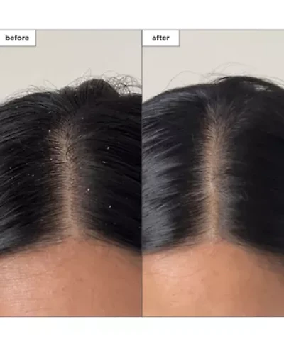 Scalp Revival Charcoal Plus Tea Tree Buildup Detox Spray