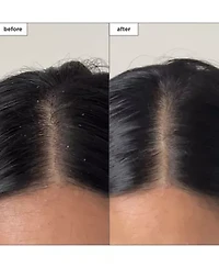 Scalp Revival Charcoal Plus Tea Tree Buildup Detox Spray