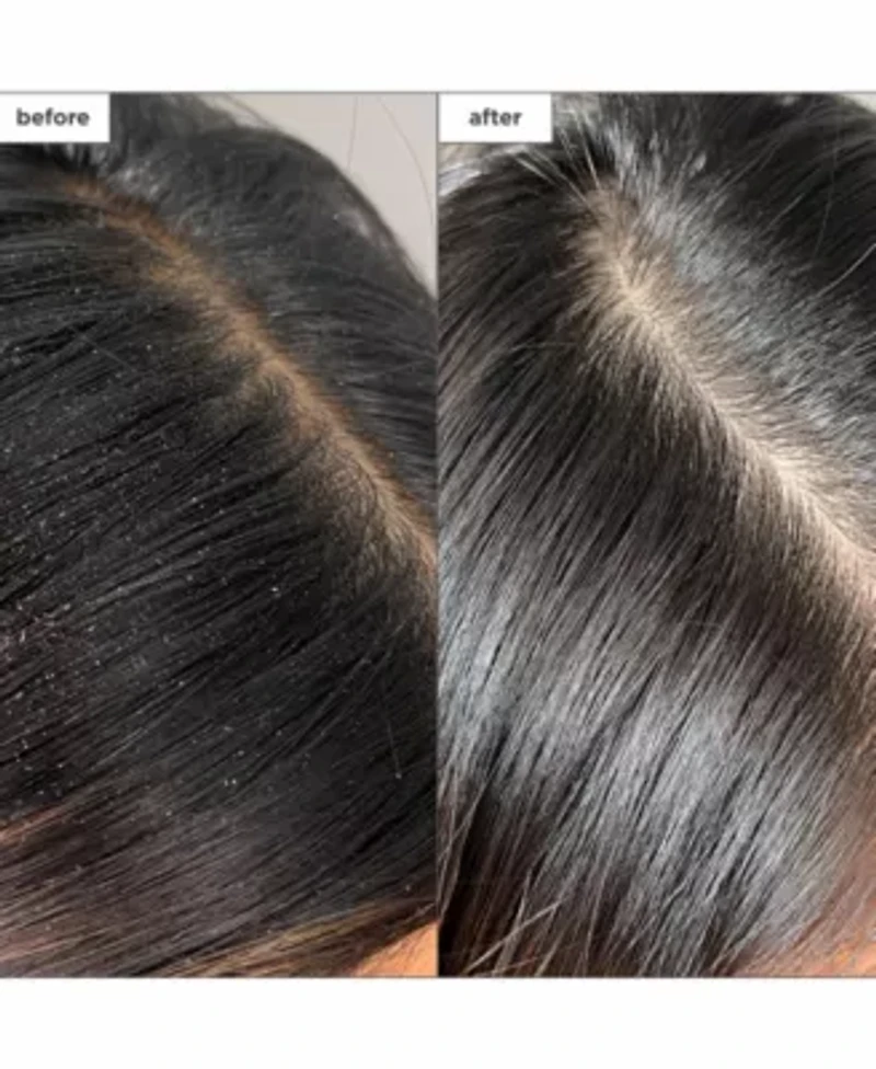 Scalp Revival Charcoal Plus Tea Tree Buildup Detox Spray