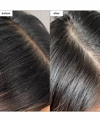 Scalp Revival Charcoal Plus Tea Tree Buildup Detox Spray