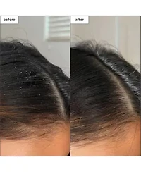 Scalp Revival Charcoal Plus Tea Tree Buildup Detox Spray