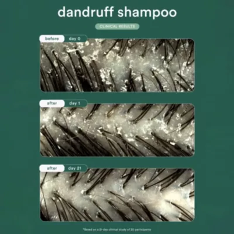 Dandruff Shampoo