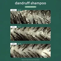Dandruff Shampoo
