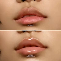 Lip Treatment Balm