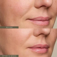 Firming Plant Peptide Serum