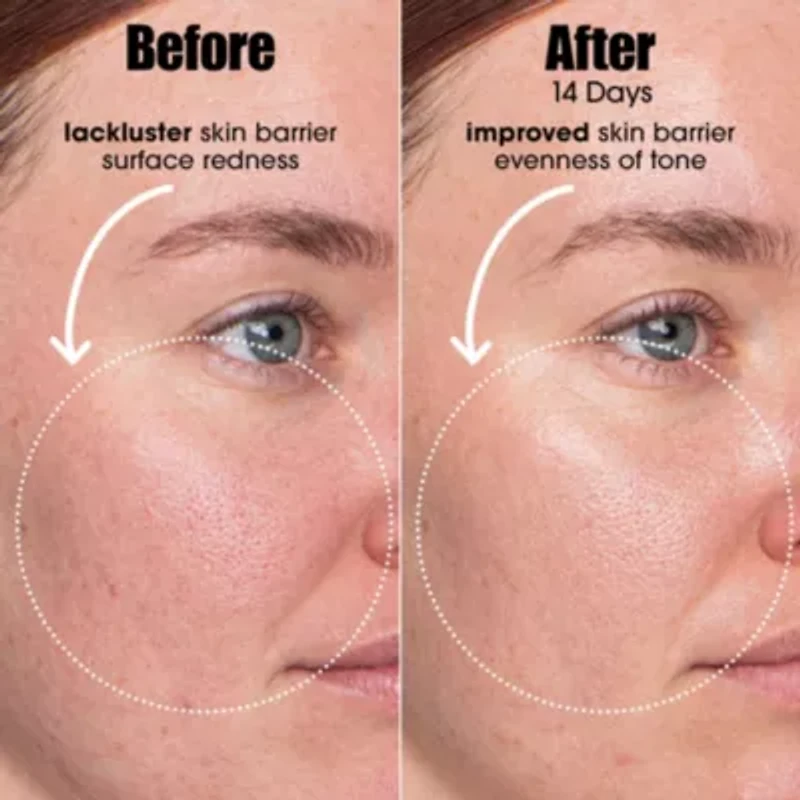 A.I. Adaptive Retinoid Serum For Blemish Prone Skin