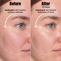 A.I. Adaptive Retinoid Serum For Blemish Prone Skin