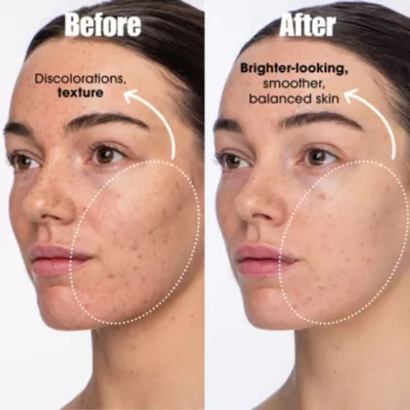 Detox Darling Balancing Essence Mist For Oily And Blemish-prone