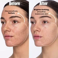 Detox Darling Balancing Essence Mist For Oily And Blemish-prone