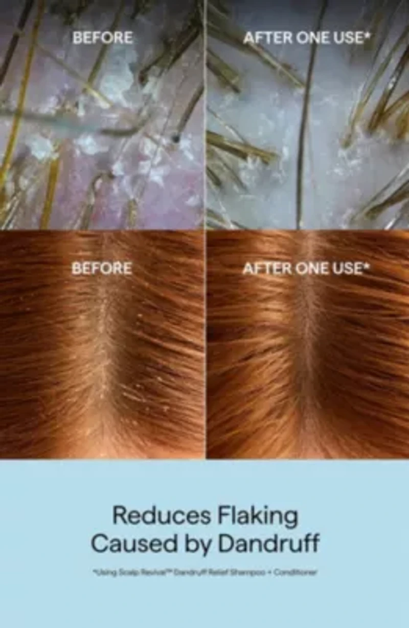 Scalp Revival Dandruff Relief Conditioner