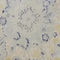 Marisa Comforter Set