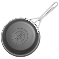 ZWILLING ® Motion 3-Piece Hard-Anodized Aluminum Frying Pan Set