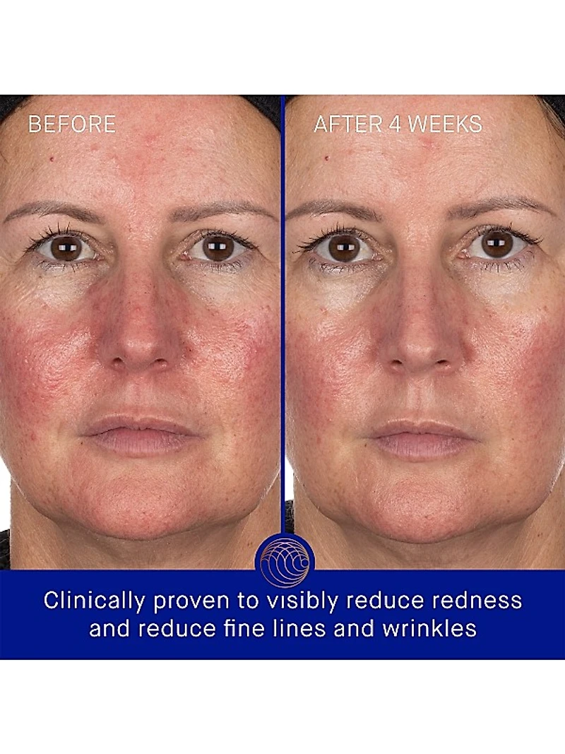 The Hydrogel Face Mask