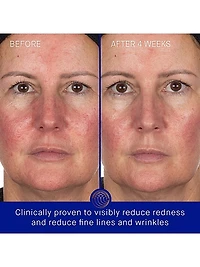 The Hydrogel Face Mask